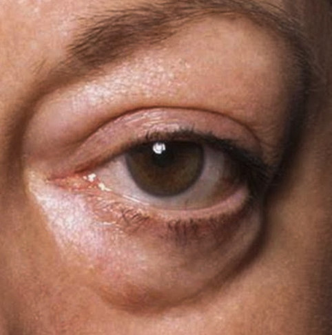 Локализация