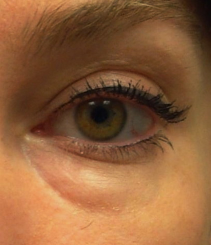 Локализация